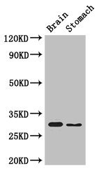 COPS7B / CSN7B Antibody - Western Blot Positive WB detected in: Mouse brain tissue, Mouse stomach tissue All lanes: COPS7B antibody at 3µg/ml Secondary Goat polyclonal to rabbit IgG at 1/50000 dilution Predicted band size: 30, 19, 31 kDa Observed band size: 30 kDa
