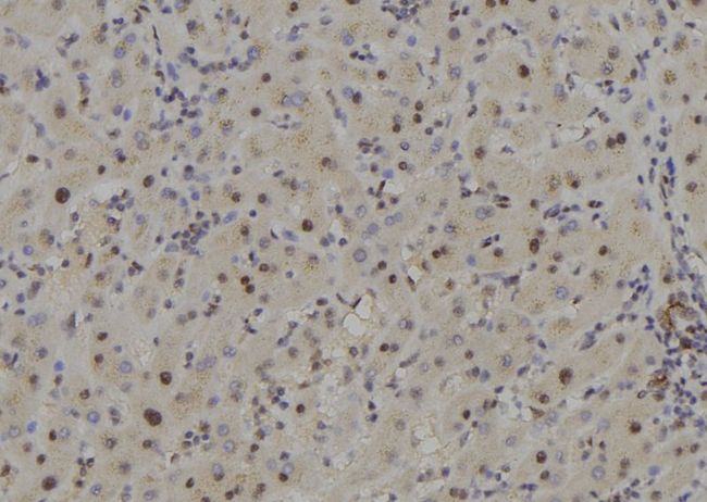 COPS7B / CSN7B Antibody - 1:100 staining human liver tissue by IHC-P. The sample was formaldehyde fixed and a heat mediated antigen retrieval step in citrate buffer was performed. The sample was then blocked and incubated with the antibody for 1.5 hours at 22°C. An HRP conjugated goat anti-rabbit antibody was used as the secondary.