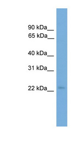 COPS8 / COP9 Antibody - COPS8 antibody Western blot of HepG2 cell lysate. This image was taken for the unconjugated form of this product. Other forms have not been tested.