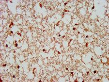COPS8 / COP9 Antibody - Immunohistochemistry image at a dilution of 1:300 and staining in paraffin-embedded human brain tissue performed on a Leica BondTM system.