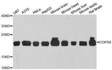 COPS8 / COP9 Antibody - Western blot analysis of extracts of various cell lines, using COPS8 antibody at 1:3000 dilution. The secondary antibody used was an HRP Goat Anti-Rabbit IgG (H+L) at 1:10000 dilution. Lysates were loaded 25ug per lane and 3% nonfat dry milk in TBST was used for blocking. An ECL Kit was used for detection and the exposure time was 60s.