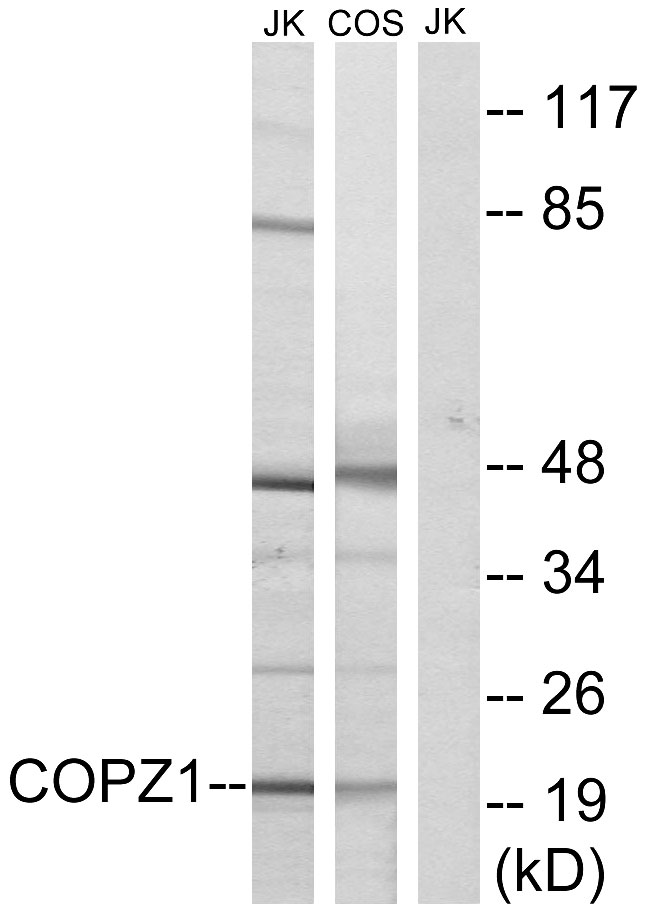 COPZ1 Antibody - Western blot analysis of lysates from Jurkat and COS cells, using COPZ1 Antibody. The lane on the right is blocked with the synthesized peptide.