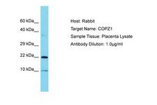 COPZ1 Antibody -  This image was taken for the unconjugated form of this product. Other forms have not been tested.