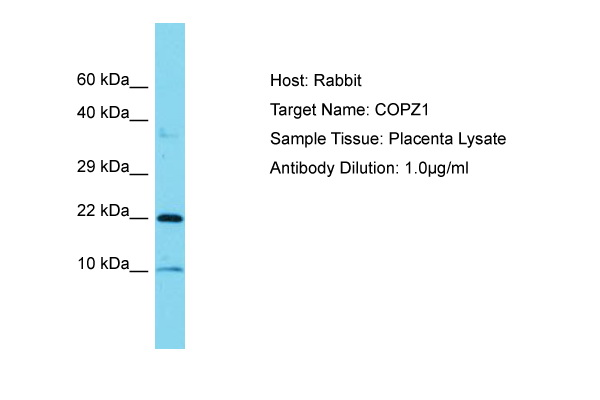 COPZ1 Antibody -  This image was taken for the unconjugated form of this product. Other forms have not been tested.