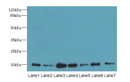 COPZ1 Antibody - Western blot. All lanes: COPZ1 antibody at 1 ug/ml. Lane 1: HeLa whole cell lysate. Lane 2: NIH/3T3 whole cell lysate. Lane 3: RAW 264.7 whole cell lysate. Lane 4: Jurkat whole cell lysate. Lane 5: Mouse liver tissue. Lane 6: Mouse kidney tissue. Lane 7: K562 whole cell lysate. Secondary Goat polyclonal to Rabbit IgG at 1:10000 dilution. Predicted band size: 20 kDa. Observed band size: 20 kDa.