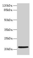 COPZ1 Antibody - Western blot All lanes: COPZ1 antibody at 1µg/ml Lane 1: Hela whole cell lysate Lane 2: NIH/3T3 whole cell lysate Lane 3: RAW 264.7 whole cell lysate Lane 4: Jurkat whole cell lysate Lane 5: Mouse liver tissue Lane 6: Mouse kidney tissue Lane 7: K562 whole cell lysate Secondary Goat polyclonal to rabbit IgG at 1/10000 dilution Predicted band size: 21, 15, 18, 22, 19 kDa Observed band size: 21 kDa
