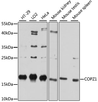 COPZ1 Antibody - Western blot analysis of extracts of various cell lines, using COPZ1 antibody at 1:3000 dilution. The secondary antibody used was an HRP Goat Anti-Rabbit IgG (H+L) at 1:10000 dilution. Lysates were loaded 25ug per lane and 3% nonfat dry milk in TBST was used for blocking. An ECL Kit was used for detection and the exposure time was 10s.