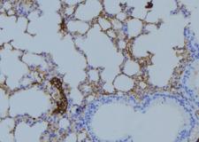 COPZ1 Antibody - 1:100 staining mouse lung tissue by IHC-P. The sample was formaldehyde fixed and a heat mediated antigen retrieval step in citrate buffer was performed. The sample was then blocked and incubated with the antibody for 1.5 hours at 22°C. An HRP conjugated goat anti-rabbit antibody was used as the secondary.