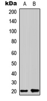 COPZ1 Antibody - Western blot analysis of Zeta COP expression in HepG2 (A); HeLa (B) whole cell lysates.