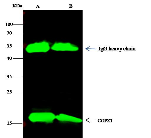 COPZ1 Antibody - rat COPZ1 was immunoprecipitated using: Lane A: 0.5 mg 293T Whole Cell Lysate. Lane B: 0.5 mg Jurkat Whole Cell Lysate. 4 uL anti-rat COPZ1 rabbit polyclonal antibody and 15 ul of 50% Protein G agarose. Primary antibody: Anti-rat COPZ1 rabbit polyclonal antibody, at 1:100 dilution. Secondary antibody: Dylight 800-labeled antibody to rabbit IgG (H+L), at 1:5000 dilution. Developed using the odssey technique. Performed under reducing conditions. Predicted band size: 17 kDa. Observed band size: 17 kDa.