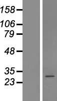 COPZ2 Protein - Western validation with an anti-DDK antibody * L: Control HEK293 lysate R: Over-expression lysate