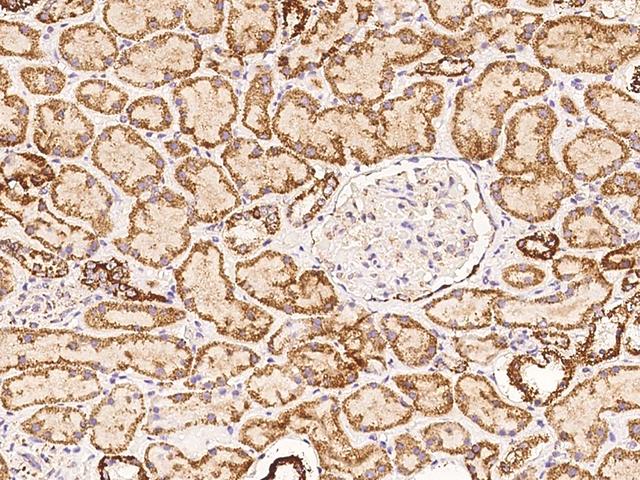COQ2 Antibody - Immunochemical staining of human COQ2 in human kidney with rabbit polyclonal antibody at 1:100 dilution, formalin-fixed paraffin embedded sections.