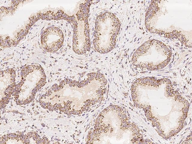 COQ2 Antibody - Immunochemical staining of human COQ2 in human prostate with rabbit polyclonal antibody at 1:100 dilution, formalin-fixed paraffin embedded sections.