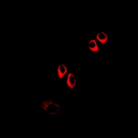 COQ3 Antibody - Immunofluorescent analysis of COQ3 staining in A549 cells. Formalin-fixed cells were permeabilized with 0.1% Triton X-100 in TBS for 5-10 minutes and blocked with 3% BSA-PBS for 30 minutes at room temperature. Cells were probed with the primary antibody in 3% BSA-PBS and incubated overnight at 4 deg C in a humidified chamber. Cells were washed with PBST and incubated with a DyLight 594-conjugated secondary antibody (red) in PBS at room temperature in the dark.