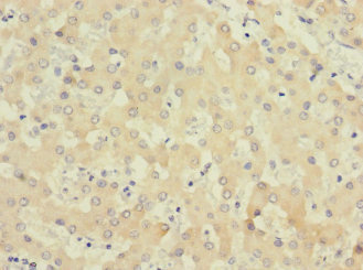 COQ4 Antibody - Immunohistochemistry of paraffin-embedded human liver tissue using COQ4 Antibody at dilution of 1:100