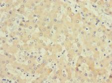 COQ4 Antibody - Immunohistochemistry of paraffin-embedded human liver tissue using COQ4 Antibody at dilution of 1:100