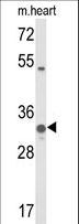 COQ5 Antibody - Western blot of COQ5 Antibody in mouse heart tissue lysates (35 ug/lane). COQ5 (arrow) was detected using the purified antibody.