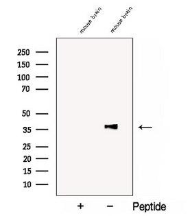 COQ5 Antibody - Western blot analysis of extracts of COLO205 cells using COQ5 antibody. The lane on the left was treated with blocking peptide.