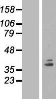 COQ5 Protein - Western validation with an anti-DDK antibody * L: Control HEK293 lysate R: Over-expression lysate