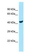 COQ6 Antibody - COQ6 antibody Western Blot of COLO205.  This image was taken for the unconjugated form of this product. Other forms have not been tested.