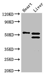 COQ6 Antibody - Positive WB detected in:Mouse heart tissue,Mouse liver tissue;All lanes:COQ6 antibody at 3?g/ml;Secondary;Goat polyclonal to rabbit IgG at 1/50000 dilution;predicted band size: 51,49,43 kDa;observed band size: 51,49 kDa;
