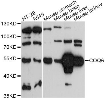 COQ6 Antibody - Western blot analysis of extracts of various cell lines, using COQ6 antibody at 1:3000 dilution. The secondary antibody used was an HRP Goat Anti-Rabbit IgG (H+L) at 1:10000 dilution. Lysates were loaded 25ug per lane and 3% nonfat dry milk in TBST was used for blocking. An ECL Kit was used for detection and the exposure time was 90s.