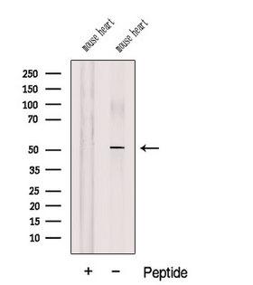 COQ6 Antibody - Western blot analysis of extracts of mouse heart tissue using COQ6 antibody. The lane on the left was treated with blocking peptide.