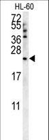 COQ7 Antibody - COQ7 Antibody western blot of HL-60 cell line lysates (35 ug/lane). The COQ7 antibody detected the COQ7 protein (arrow).