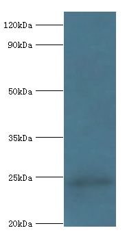 COQ7 Antibody - Western blot. All lanes: Ubiquinone biosynthesis protein COQ7 homolog antibody at 6 ug/ml+rat heart tissue. Secondary antibody: Goat polyclonal to rabbit at 1:10000 dilution. Predicted band size: 24 kDa. Observed band size: 24 kDa Immunohistochemistry.