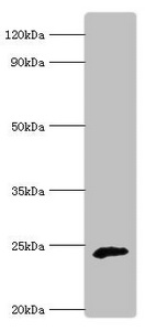 COQ7 Antibody - Western blot All lanes: Ubiquinone biosynthesis protein COQ7 homolog antibody at 6µg/ml + Rat heart tissue Secondary Goat polyclonal to rabbit IgG at 1/10000 dilution Predicted band size: 25, 21 kDa Observed band size: 25 kDa