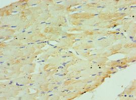 COQ7 Antibody - Immunohistochemistry of paraffin-embedded human skeletal muscle using antibody at 1:100 dilution.