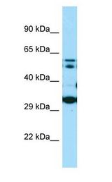 COQ7 Antibody - COQ7 antibody Western Blot of MDA-MB-435S.  This image was taken for the unconjugated form of this product. Other forms have not been tested.