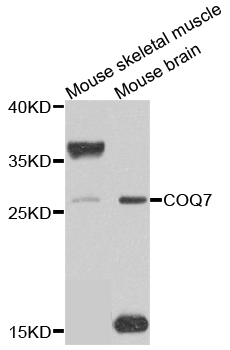 COQ7 Antibody - Western blot analysis of extracts of mouse testis.