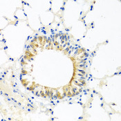 COQ7 Antibody - Immunohistochemistry of paraffin-embedded mouse lung tissue.