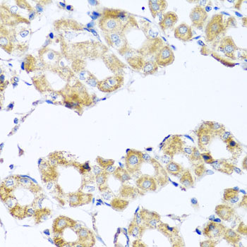 COQ7 Antibody - Immunohistochemistry of paraffin-embedded human stomach tissue.