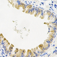 COQ7 Antibody - Immunohistochemical analysis of COQ7 staining in mouse lung formalin fixed paraffin embedded tissue section. The section was pre-treated using heat mediated antigen retrieval with sodium citrate buffer (pH 6.0). The section was then incubated with the antibody at room temperature and detected using an HRP conjugated compact polymer system. DAB was used as the chromogen. The section was then counterstained with hematoxylin and mounted with DPX.