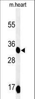 COQ9 Antibody - Western blot of COQ9 Antibody in mouse heart tissue lysates (35 ug/lane). COQ9 (arrow) was detected using the purified antibody.