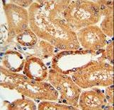 COQ9 Antibody - COQ9 Antibody immunohistochemistry of formalin-fixed and paraffin-embedded human lung tissue followed by peroxidase-conjugated secondary antibody and DAB staining.