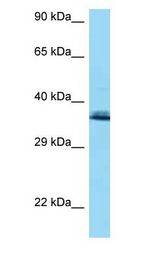 COQ9 Antibody - COQ9 antibody Western Blot of HCT15.  This image was taken for the unconjugated form of this product. Other forms have not been tested.
