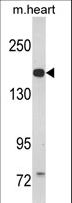 CORIN Antibody - Western blot of CORIN Antibody in mouse heart tissue lysates (35 ug/lane). CORIN (arrow) was detected using the purified antibody.
