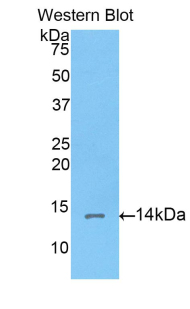 CORIN Antibody - Western blot of recombinant CORIN.  This image was taken for the unconjugated form of this product. Other forms have not been tested.