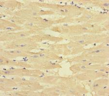 CORIN Antibody - Immunohistochemistry of paraffin-embedded human heart tissue at dilution of 1:100