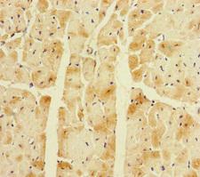 CORIN Antibody - Immunohistochemistry of paraffin-embedded human heart tissue at dilution of 1:100