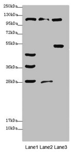 CORIN Antibody - Western blot All Lanes: CORIN antibody at 3.78 ug/ml Lane 1: Rat heart tissue Lane 2: Mouse liver tissue Lane 3: HepG-2 whole cell lysate Secondary Goat polyclonal to rabbit IgG at 1/10000 dilution Predicted band size: 117,114 kDa Observed band size: 116,49,45,36,28 kDa