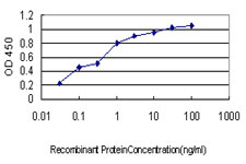 Corneodesmosin / CDSN Antibody - Detection limit for recombinant GST tagged CDSN is approximately 0.03 ng/ml as a capture antibody.