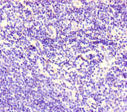Corneodesmosin / CDSN Antibody - Immunohistochemistry of paraffin-embedded human lymphoid tissue at dilution of 1:100