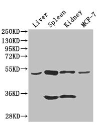 Corneodesmosin / CDSN Antibody - Western Blot Positive WB detected in:mouse liver tissue,mouse spleen tissue,mouse kidney tissue,MCF7 whole cell lysate All Lanes: CDSN antibody at 3ug/ml Secondary Goat polyclonal to rabbit IgG at 1/50000 dilution Predicted band size: 52 kDa Observed band size: 52,34 kDa