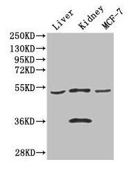 Corneodesmosin / CDSN Antibody - Western Blot Positive WB detected in: Mouse liver tissue, Mouse kidney tissue, MCF-7 whole cell lysate All lanes: CDSN antibody at 3µg/ml Secondary Goat polyclonal to rabbit IgG at 1/50000 dilution Predicted band size: 52 kDa Observed band size: 52 kDa