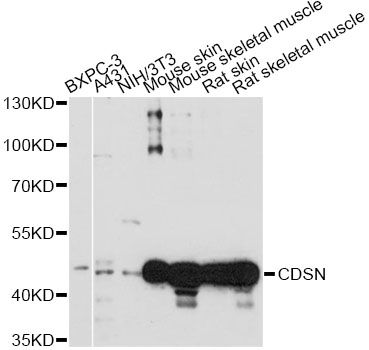 Corneodesmosin / CDSN Antibody - Western blot analysis of extracts of various cell lines, using CDSN antibody at 1:1000 dilution. The secondary antibody used was an HRP Goat Anti-Rabbit IgG (H+L) at 1:10000 dilution. Lysates were loaded 25ug per lane and 3% nonfat dry milk in TBST was used for blocking. An ECL Kit was used for detection and the exposure time was 60s.