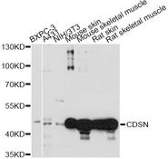 Corneodesmosin / CDSN Antibody - Western blot analysis of extracts of various cell lines, using CDSN antibody at 1:1000 dilution. The secondary antibody used was an HRP Goat Anti-Rabbit IgG (H+L) at 1:10000 dilution. Lysates were loaded 25ug per lane and 3% nonfat dry milk in TBST was used for blocking. An ECL Kit was used for detection and the exposure time was 60s.